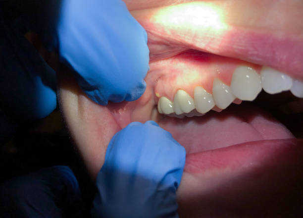 Best After-Hours Dental Care in New London, TX