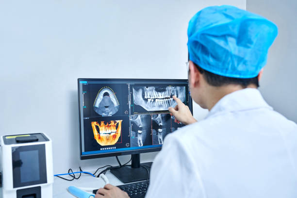 Best Knocked-Out Tooth (Avulsed Tooth) Treatment in New London, TX