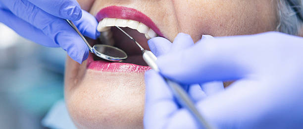 Best Emergency Root Canal Therapy in New London, TX